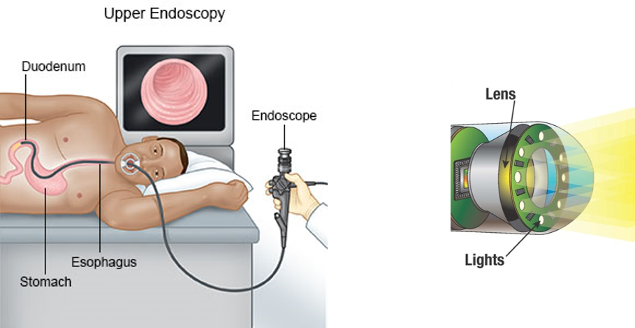  2020-10-22-medical-image-acquisition-5-endoscopy