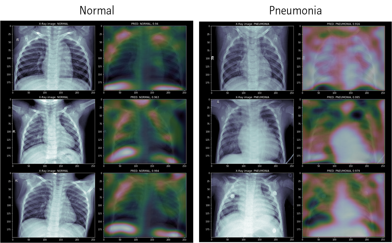2020-11-02-classification-for-medical-image-7-feature-selection-extraction-4-CAM.png